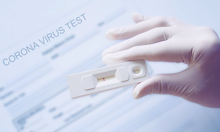 à¸‚ à¸­à¸„à¸§à¸£à¸£ à¹€à¸ à¸¢à¸§à¸ à¸š Rapid Test à¸ªà¸³à¸«à¸£ à¸šà¸•à¸£à¸§à¸ˆà¹‚à¸£à¸„ à¹‚à¸„à¸§ à¸