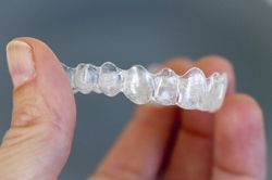 จัดฟันแบบใส ไร้เหล็ก (Invisalign)