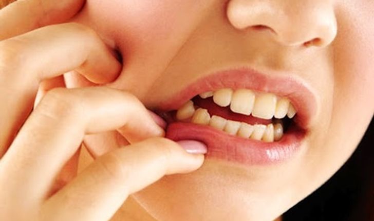 อย่ากลัวเจ็บ…ปัญหาฟันคุดไม่อันตรายอย่างที่คิด