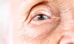 มองเห็นไม่ชัด สัญญาณอันตราย 5 โรค “ตา” ที่ผู้สูงอายุควรระวัง