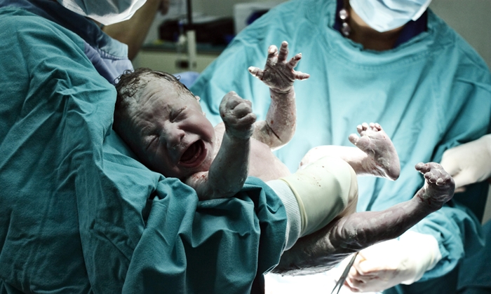 สูติแพทย์แนะ รอ 30–60 วินาที ก่อนตัดสายรกหลังทารกคลอด