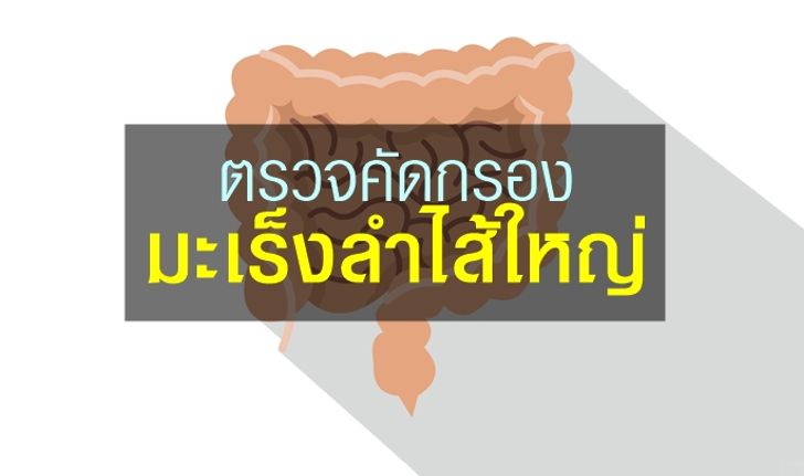 มะเร็งลำไส้ใหญ่ ป้องกันได้ด้วยการ “ตรวจคัดกรอง”