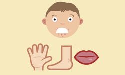 5 เรื่องที่หลายคนยังไม่รู้เกี่ยวกับโรค "มือเท้าปาก"