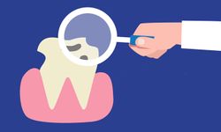 สุขภาพฟันวัยทำงาน ปัญหาใหญ่ที่อย่าชะล่าใจ