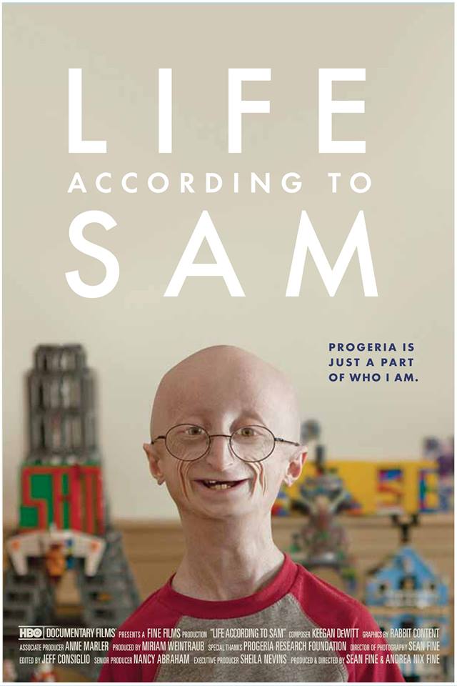 progeria-3