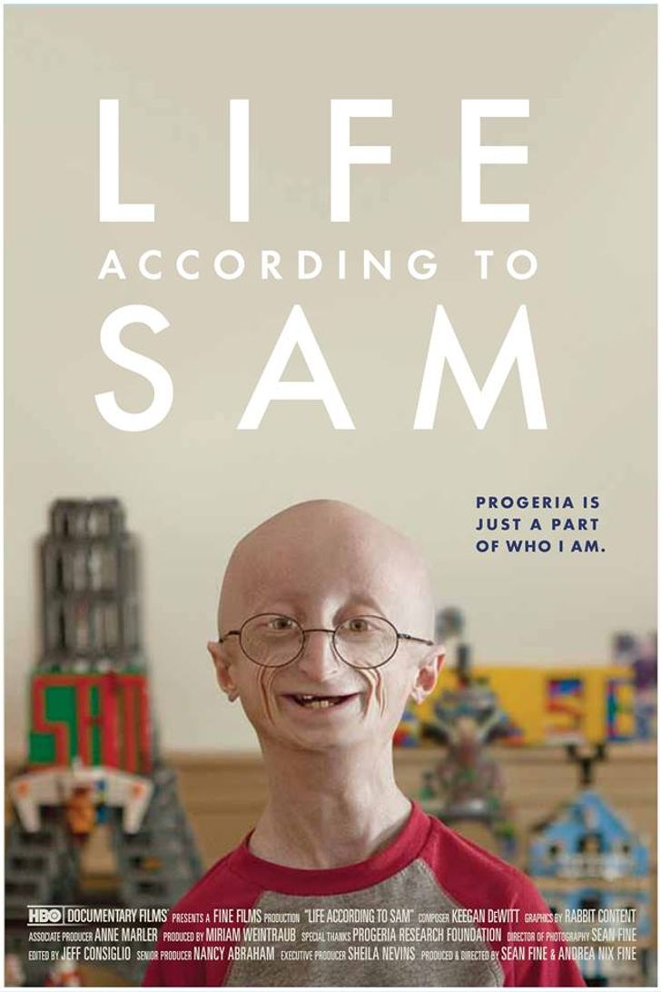 progeria-3