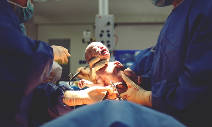 แพทย์เตือน! การ "ผ่าตัดคลอดบุตร" กำลังเเพร่ระบาดไปทั่วโลก