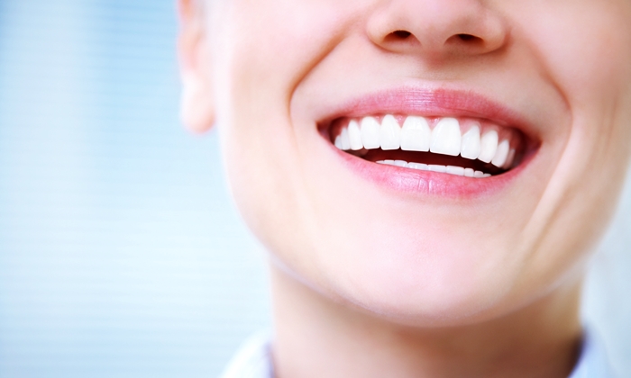 "วีเนียร์” ฟันขาวเรียงขนาดสวยราวกับดารา กับ 10 ข้อเสียที่ควรทราบก่อนทำ