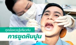 ทุกข้อควรรู้เกี่ยวกับการขูดหินปูน