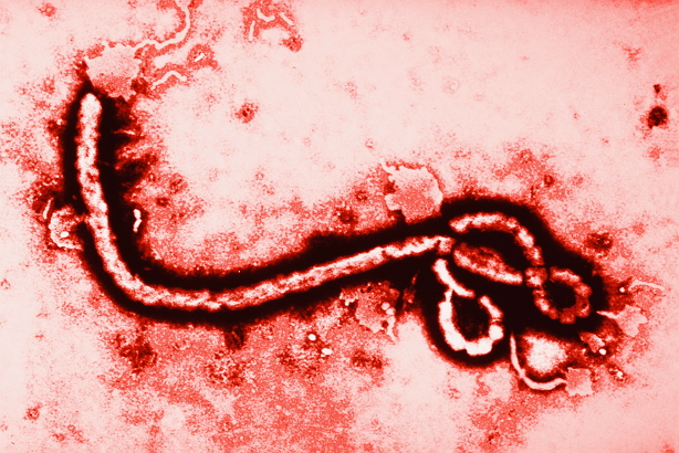 โรคติดเชื้อไวรัสอีโบลา (Ebola)