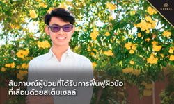 สัมภาษณ์ผู้ป่วยที่ได้รับการฟื้นฟูผิวข้อที่เสื่อมด้วย สเต็มเซลล์