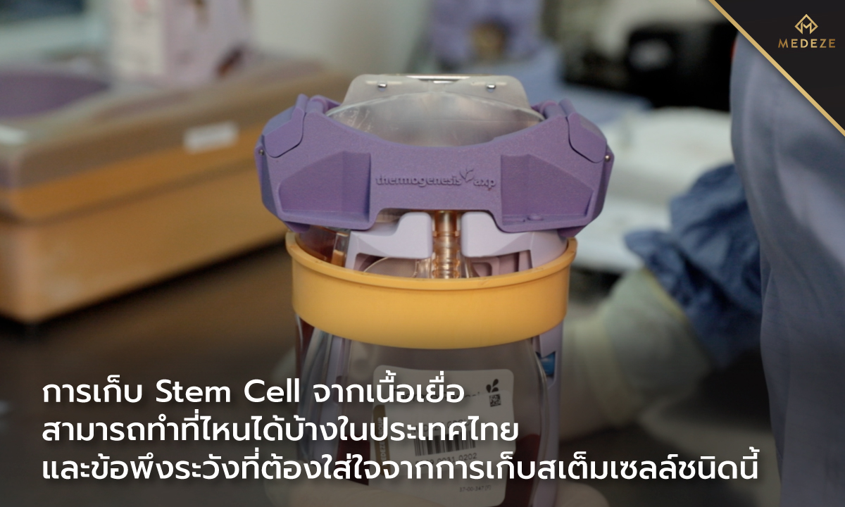 การเก็บ Stem Cell จากเนื้อเยื่อสามารถทำที่ไหนได้บ้างในประเทศไทย และข้อพึงระวังที่ต้องใส่ใจจากการเก็บสเต็มเซลล์ชนิดนี้