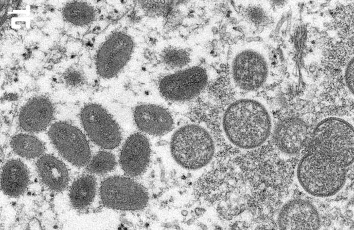 ภาพตัดขวางจากชิ้นส่วนผิวหนังของผู้ติดเชื้อฝีดาษลิง (Monkeypox) จากการแพร่ระบาดในปี ค.ศ. 2003 ด้านซ้าย (รูปไข่รี ๆ สีเทาเข้ม) เป็นไวรัสที่โตเต็มวัย ส่วนด้านขวารูปร่างกลม มีวงสีเทาเข้ม ด้านในสีเทาอ่อน เป็นไวรัสที่ยังไม่โตเต็มวัย (ภาพ : Cynthia S. Goldsmith, Russell Regnery )