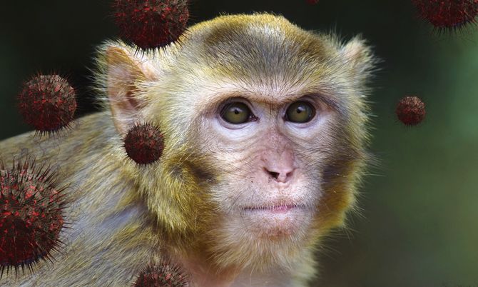 7 ข้อควรรู้เกี่ยวกับ "ฝีดาษลิง" ที่หลายคนอาจเข้าใจผิด