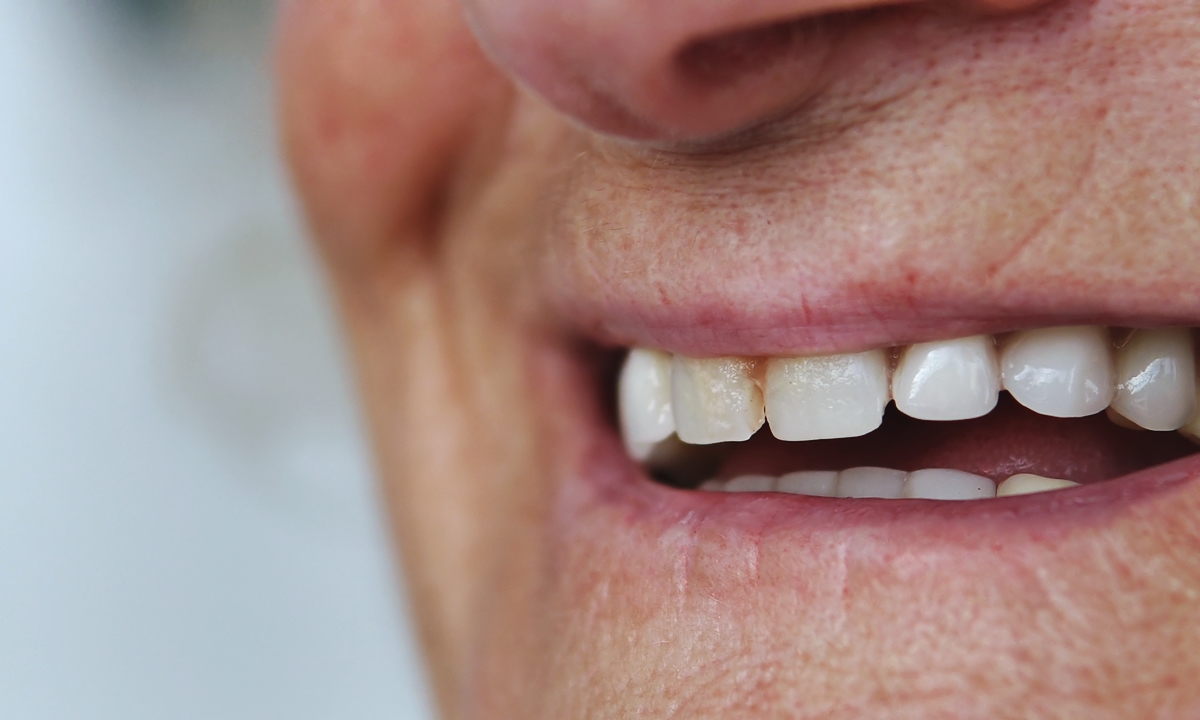 6 ปัญหาสุขภาพช่องปากในผู้สูงอายุที่พบได้บ่อย