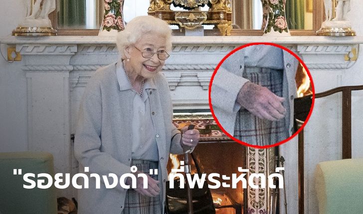 “รอยด่างดำ” ที่พระหัตถ์ของ “ควีนเอลิซาเบธที่ 2” คืออะไร