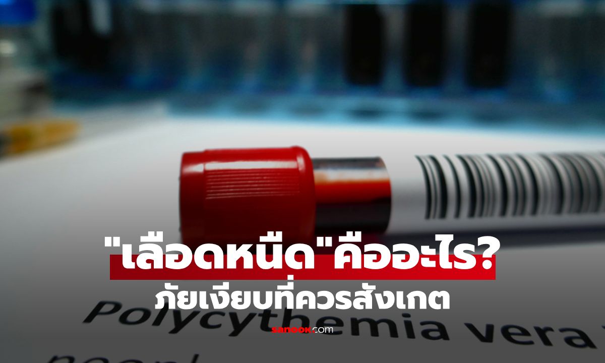 เลือดหนืด ภัยเงียบที่ต้องรู้ทัน ปรับพฤติกรรมก่อนเสี่ยงโรคร้าย