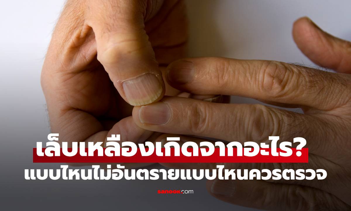 เล็บเหลืองเกิดจากอะไรบ้าง? แบบไหนไม่อันตราย และแบบไหนควรตรวจ