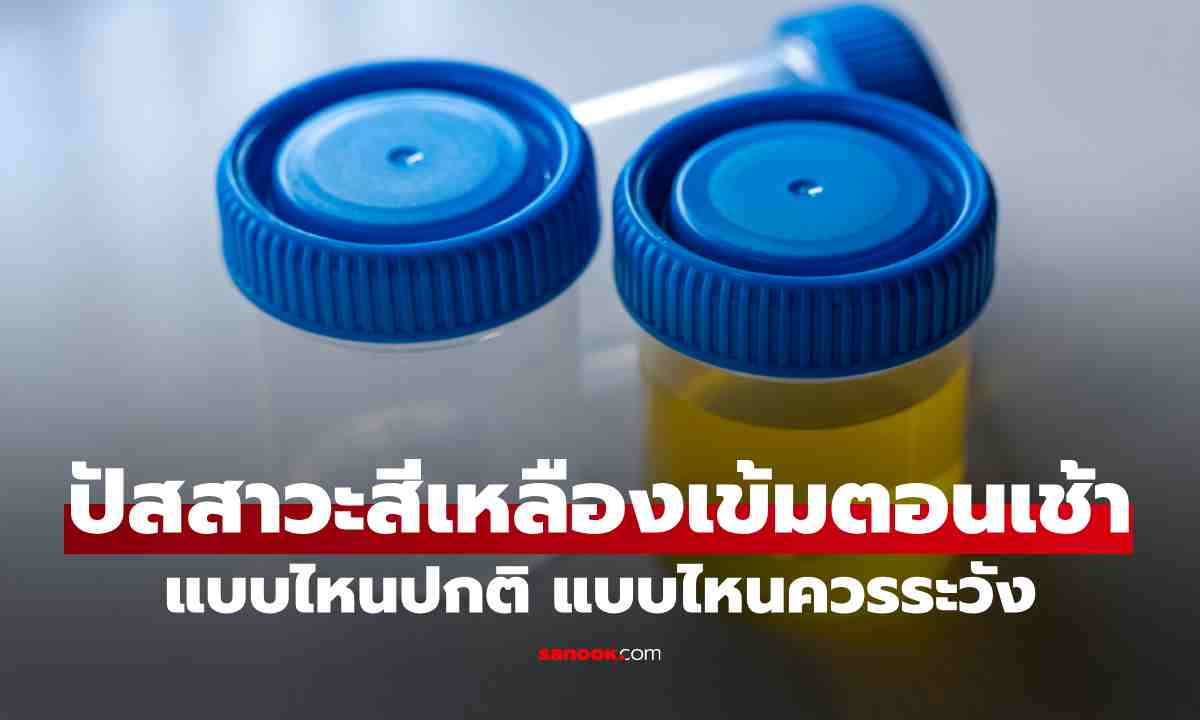 ปัสสาวะสีเหลืองเข้มตอนเช้า แบบไหนปกติ แบบไหนควรระวัง