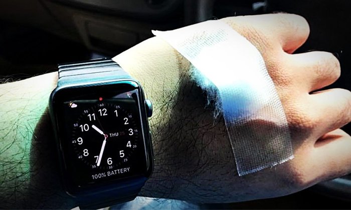 หนุ่มไทยเผยนาทีชีวิต คำเตือน Apple Watch เกี่ยวกับอัตราการเต้นของหัวใจ