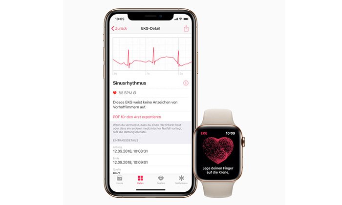 ชาวยุโรปและฮ่องกง เตรียมเฮ Apple ปล่อยแอป ECG ให้ใช้แล้วใน watchOS 5.2