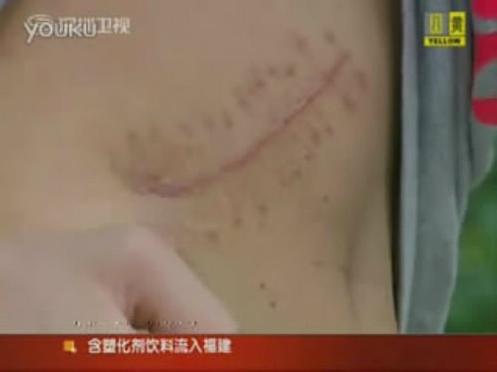 (18+) รวบ 5 พ่อค้าจีนหัวโจกขบวนการขายไตแลก iPad 2, iPhone 4!