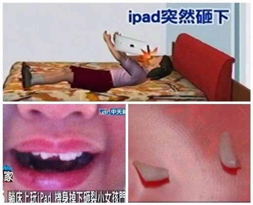 หนูน้อยนอนเล่น New iPad เครื่องร่วงกระแทกหน้าฟันหักยับ! (มีคลิป)