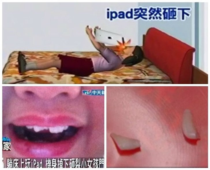 หนูน้อยนอนเล่น New iPad เครื่องร่วงกระแทกหน้าฟันหักยับ! (มีคลิป)