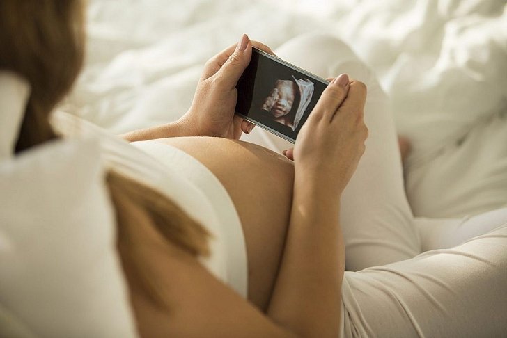 Pregnancy Baby What to Expect แอปที่คุณพ่อ คุณแม่ ที่กำลังจะมี เจ้าตัวน้อย ต้องโหลด