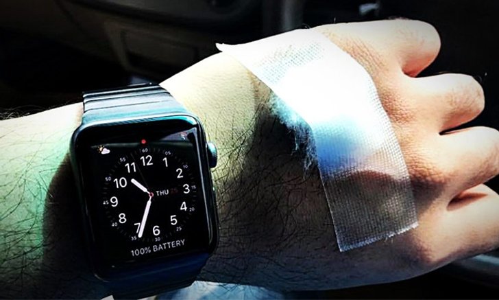 หนุ่มไทยเผยนาทีชีวิต คำเตือน Apple Watch เกี่ยวกับอัตราการเต้นของหัวใจ