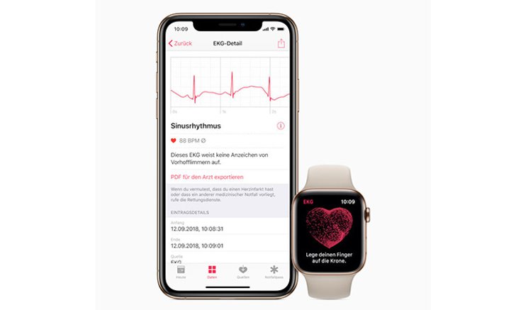 ชาวยุโรปและฮ่องกง เตรียมเฮ Apple ปล่อยแอป ECG ให้ใช้แล้วใน watchOS 5.2