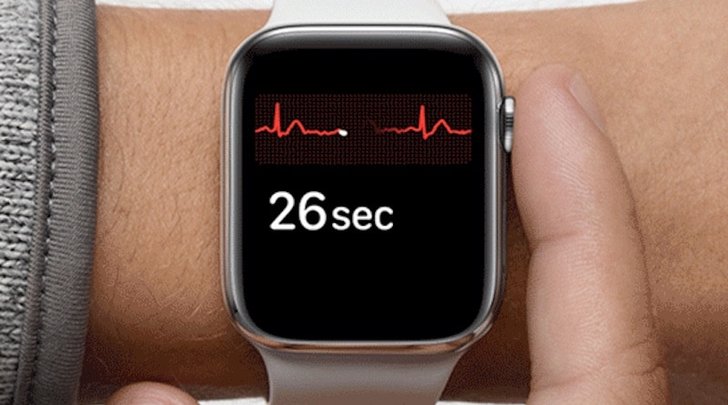 Apple Watch ช่วยชีวิต ชายคนหนึ่งจากอาการ หัวใจเต้นเร็วผิดปกติ