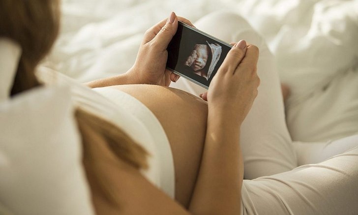 Pregnancy Baby What to Expect แอปที่คุณพ่อ คุณแม่ ที่กำลังจะมี เจ้าตัวน้อย ต้องโหลด