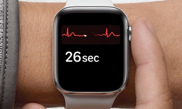 Apple Watch ช่วยชีวิต ชายคนหนึ่งจากอาการ หัวใจเต้นเร็วผิดปกติ