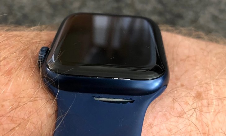 เมื่อสาย Solo Loop ของ Apple Watch ดันบอบบางกว่าที่คิด (เยอะ)