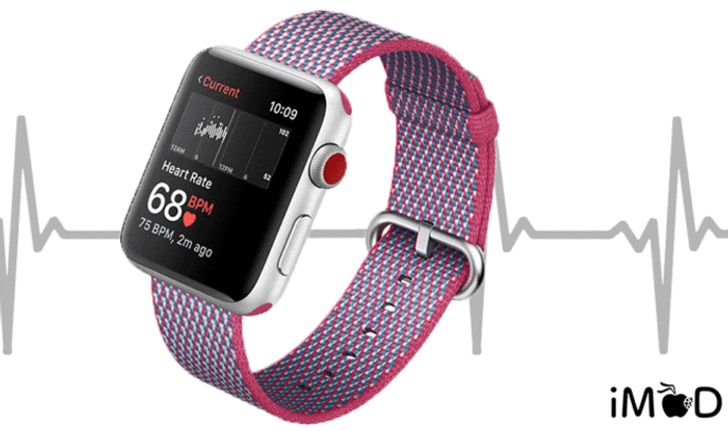 Apple Watch รุ่นใหม่ อาจมาพร้อมกับฟีเจอร์วัดคลื่นไฟฟ้าหัวใจ (EKG/ECG)