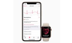 ชาวยุโรปและฮ่องกง เตรียมเฮ Apple ปล่อยแอป ECG ให้ใช้แล้วใน watchOS 5.2    