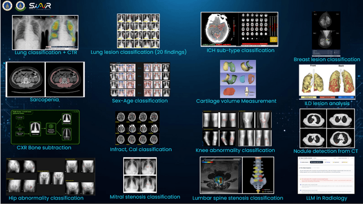 16modelx-ray