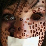 trypophobia โรคกลัวรู คำฮิตในโลกโซเชียล