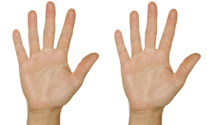 ทำนายดวงดูลายมือจาก เส้นสมรส