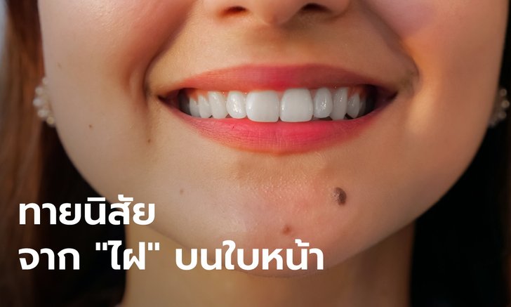 ทายนิสัย จาก "ไฝ" บริเวณใบหน้า