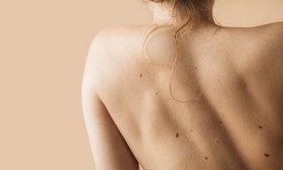 เปิด 10 ตำแหน่ง ไฝโชคดี บนใบหน้าและร่างกาย ทำนายความหมายแต่ละจุด