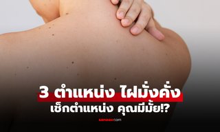 คุณมีมั้ย!? 3 ตำแหน่ง "ไฝ" บนร่างกาย ที่บ่งบอกโชคชะตาร่ำรวย มั่งคั่ง