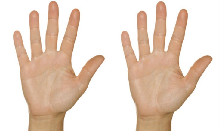 ทำนายดวงดูลายมือจาก เส้นสมรส