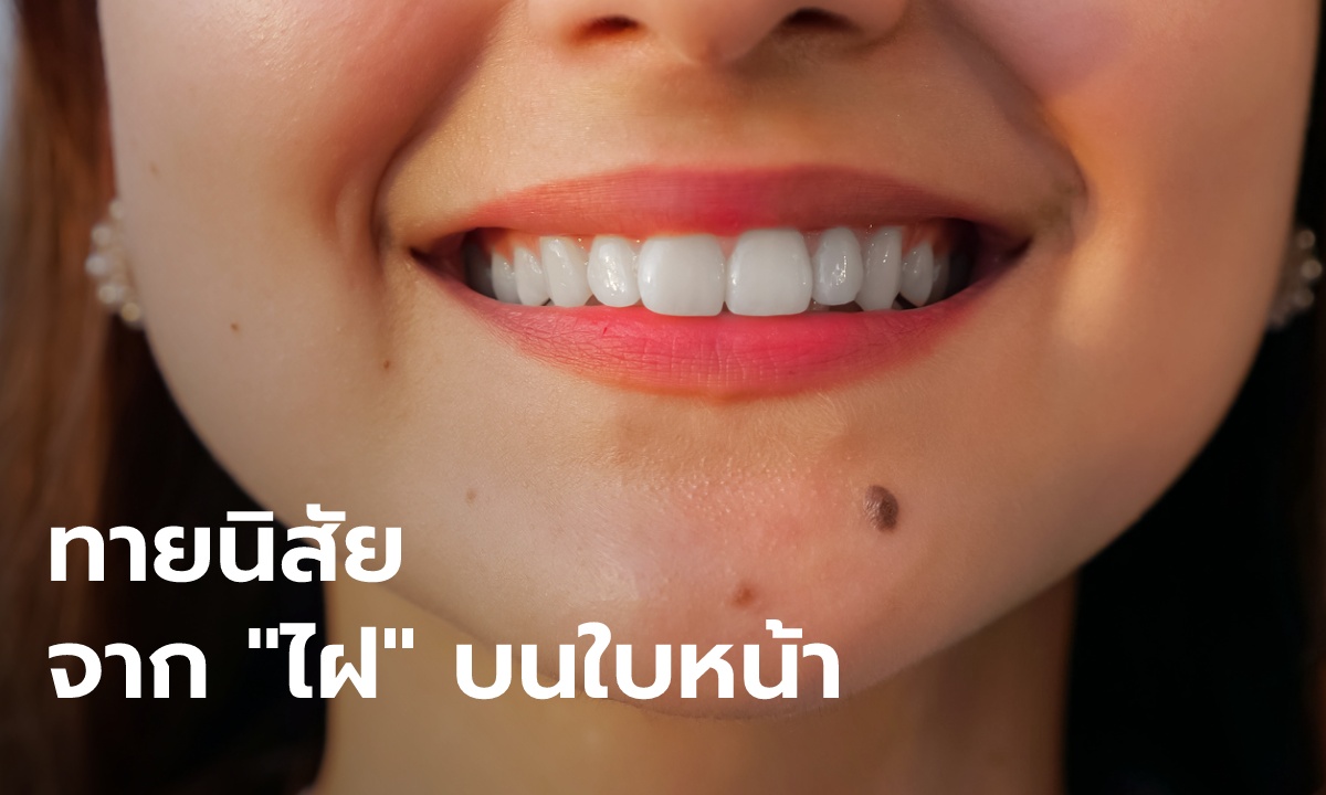 ทายนิสัย จาก "ไฝ" บริเวณใบหน้า