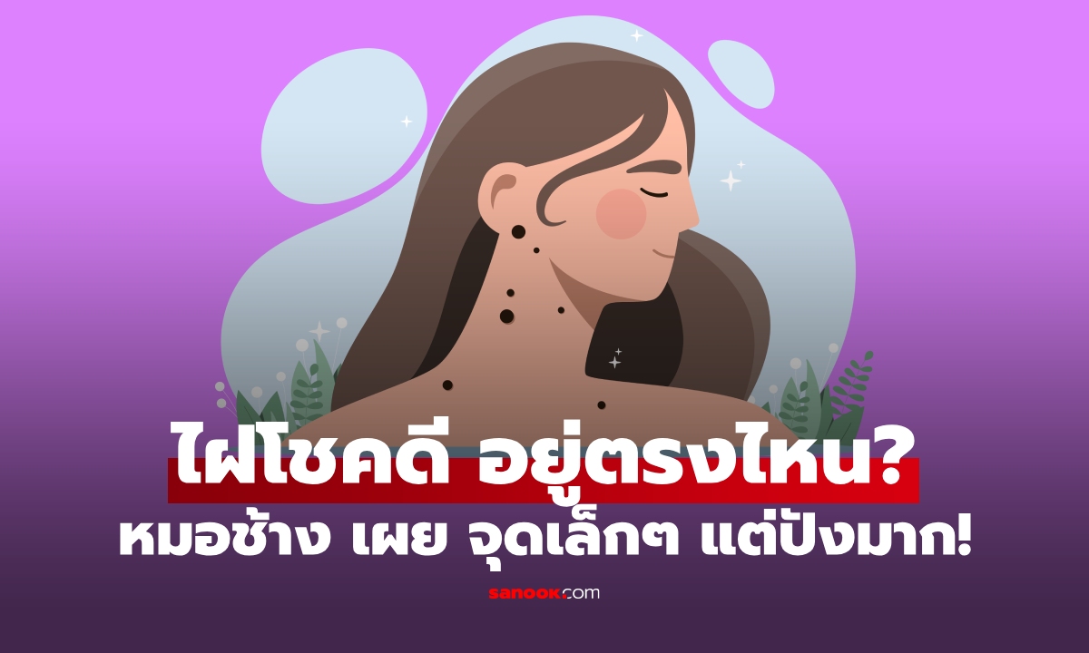 เปิดตำแหน่ง "ไฝแห่งโชคดี" หมอช้าง ชี้จุดนำโชคสู่ชีวิต