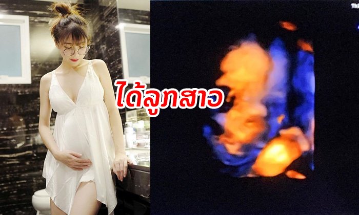 ໄດ້ລູກສາວ! ແມ່ "ແອັບເປິ້ນ" ໂພສຮູບ ultrasound ບອກເພດລູກໃນທ້ອງ ດ້ານພໍ່ບອກ "ຊິຈົ່ງໜວດຖ້າ"