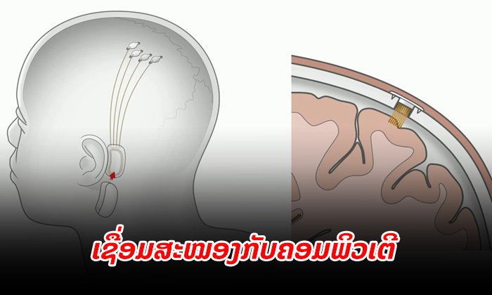 ນັກທຸລະກິດດັງ ນຳສະເໜີຄວາມເປັນໄປໄດ້ "ເຊື່ອມສະໝອງູຄົນກັບຄອມພິວເຕີ"