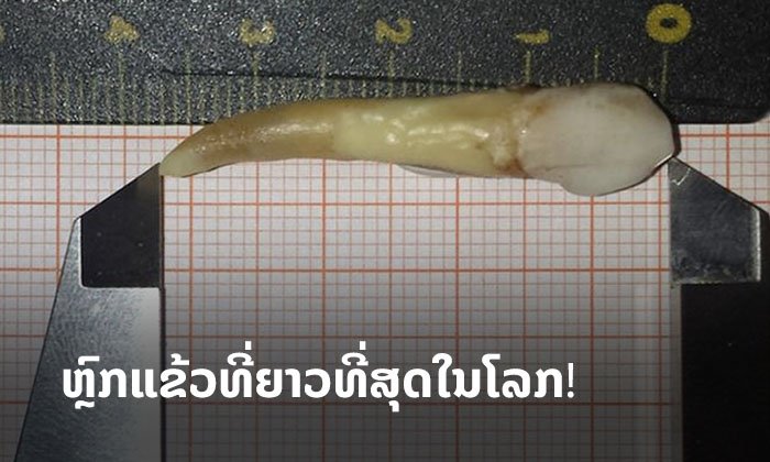 ທັນຕະແພດເຢຍລະມັນ ທຸບສະຖິຕິ ຫຼົກແຂ້ວເຫຼັ້ມທີ່ຍາວທີ່ສຸດໃນໂລກ