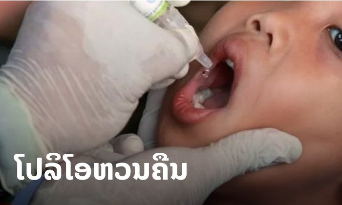ມາເລເຊຍຢືນຢັນ ພົບຜູ້ປ່ວຍ "ໂປລິໂອ" ລາຍທຳອິດໃນຮອບເກືອບ 3 ທົດສະວັດ